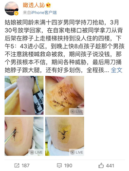 Deng, the girl's mother, posted on Weibo to unveil what happened to her daughter. / Screenshot from Weibo 