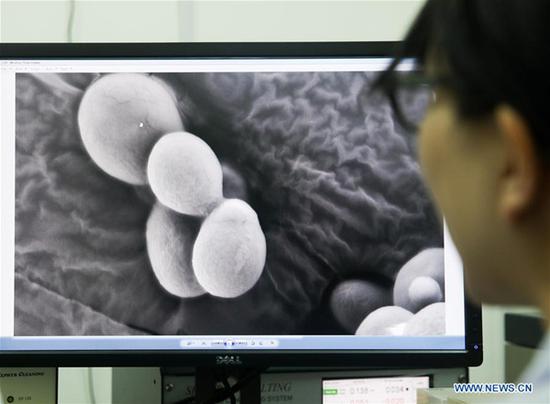A team member of molecular biologist Qin Zhongjun watches a single chromosome yeast strain through electron microscope at the Center for Excellence in Molecular Plant Sciences, Shanghai Institute of Plant Physiology and Ecology, of Chinese Academy of Sciences in Shanghai, east China, July 31, 2018. (Xinhua/Ding Ting)