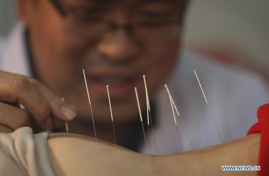 File photo taken on March 11, 2011 shows a doctor practicing acupuncture at a clinic in Beijing, capital of China. 