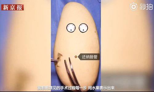Wang Yexiao, 35, does an appendectomy on a mango with two 