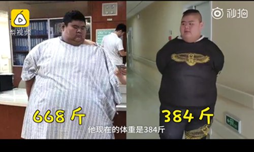 Wang Haonan in East China's Shandong Province is now 192 kilograms, who was 334 kilograms before the surgery. (Screenshot photo/Pear Video)