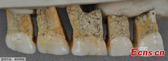 From right to left, two premolars and three molars from the upper right jaw of the same Homo Luzonensis adult. (Photo/Agencies)