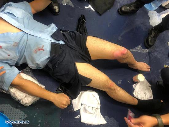 Photo taken on Aug. 11, 2019 shows an injured Hong Kong police officer. One police officer was seriously injured as gasoline bombs were thrown at police officers at multiple locations in Hong Kong on Sunday night. (Xinhua)