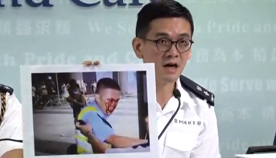 Hong Kong police shows an evidence image of injured officer bleeding during operation during press conference in September 20. /Screenshot photo