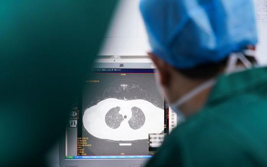 A doctor checks the CT image of a patient's lungs in Zhangzhou Municipal Hospital in Zhangzhou, southeast China's Fujian Province, Feb. 2, 2020. (Photo by Xiao Heyong/Xinhua)