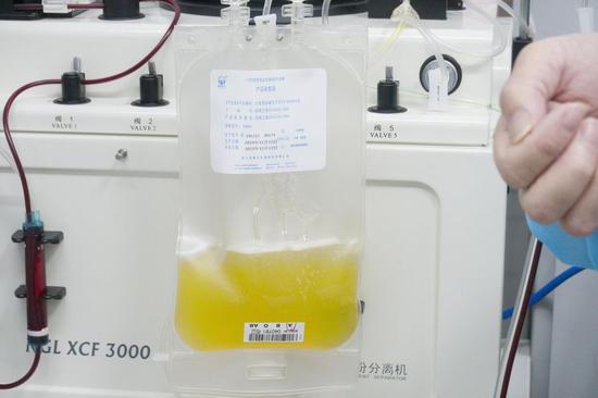 Donated plasma of a recovered coronavirus patient is seen at Wuhan Blood Center in Wuhan, capital of central China's Hubei Province, Feb. 17, 2020. (Xinhua/Cai Yang)