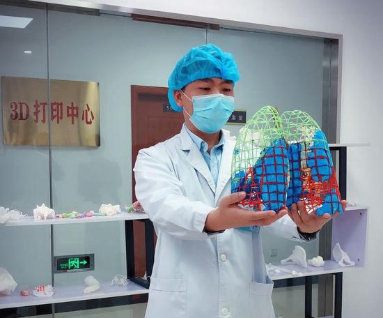 A model shows both lungs of a patient infected with the novel coronavirus. It was made with 3D printing technology at First People's Hospital of Chenzhou in Hunan province. (Photo provided to chinadaily.com.cn)