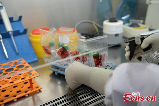 In pics: Inside nucleic acid test lab
