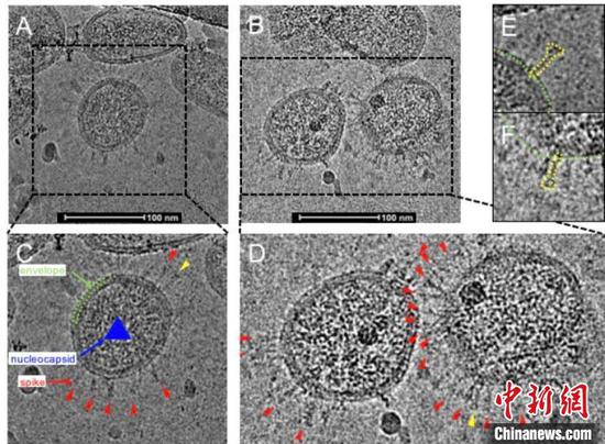 The image of inactivated novel coronavirus under the cryo-electron microscope. (Photo provided to China News Service)