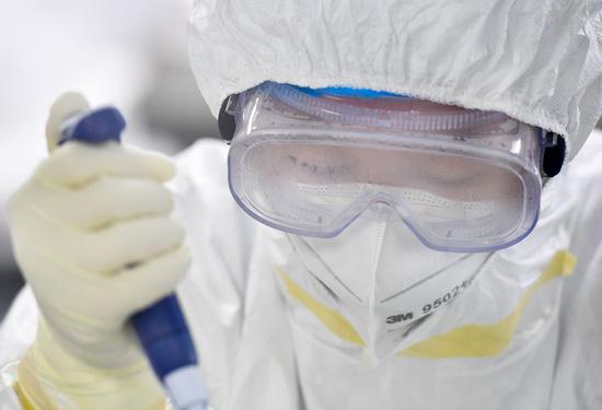 Medical worker Feng Limin's goggles are blurred after long-time work at the Diagnostics Virology and Transformation Center of the Guangzhou KingMed Diagnostics Group Co., Ltd. in Guangzhou, south China's Guangdong Province, Feb. 18, 2020. (Xinhua/Liu Dawei)