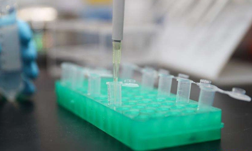 New testing kit able to detect 15 strains of novel coronavirus