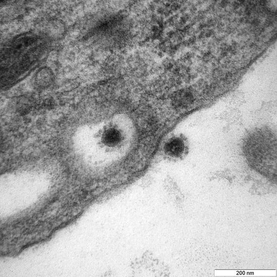 Micrograph of COVID-19 Delta strain