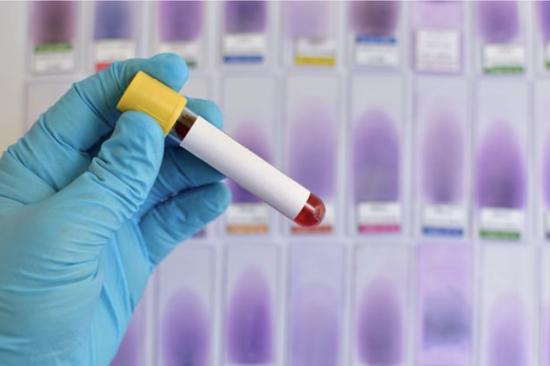 China's BGI rolls out test kit targeting acute hepatitis in children