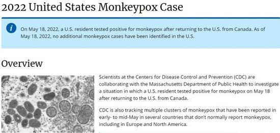 The screenshot taken from the website of the U.S. Centers for Disease Control and Prevention (CDC) shows the agency's report about the United States' confirmed case of monkeypox which is in a man in Massachusetts, who recently returned home from Canada. (Xinhua)