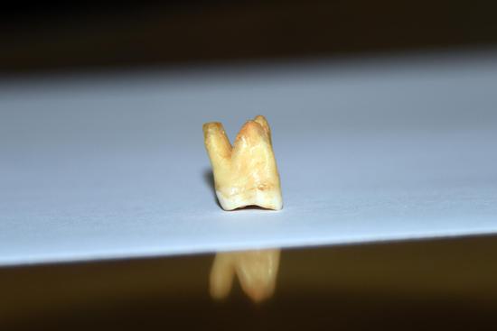Scientists find evidence of tooth-picking habit of earliest modern humans in East Asia