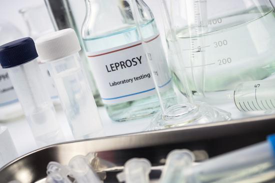 2030 goal set to eliminate leprosy cases