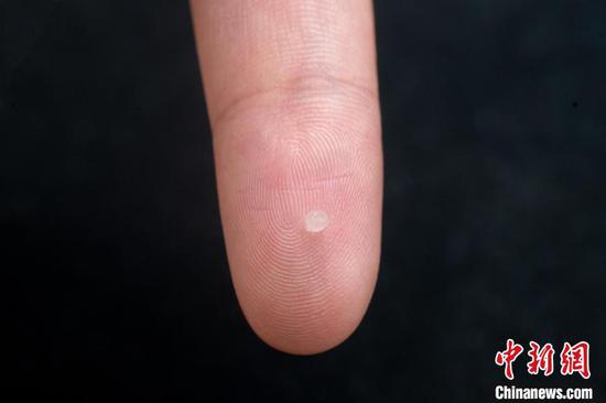 A gel-based tiny sensor that is implantable, biodegradable and wireless for data transfer is seen in Wuhuan, central China's Hubei Province, May 5, 2025. (Photo/China News Service)