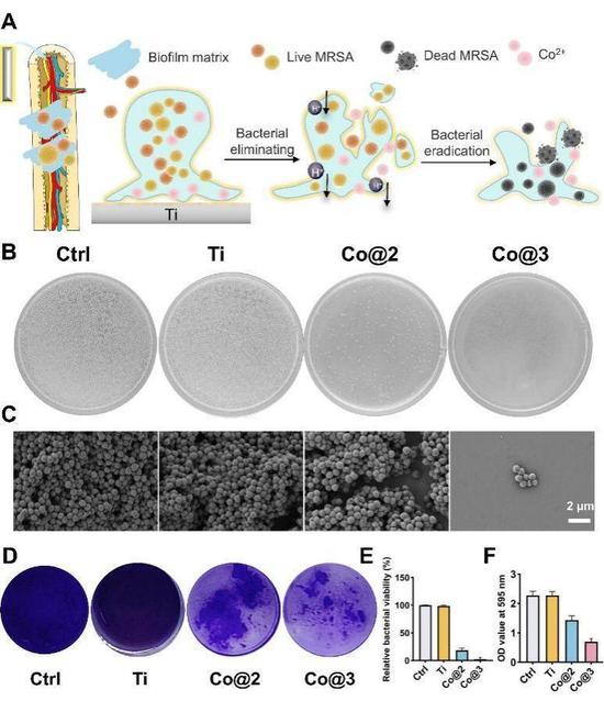 Chinese researchers have achieved a major breakthrough in orthopedic treatment with a new implant material designed to accelerate bone healing and minimize infections. (Photo/Science and Technology Daily)