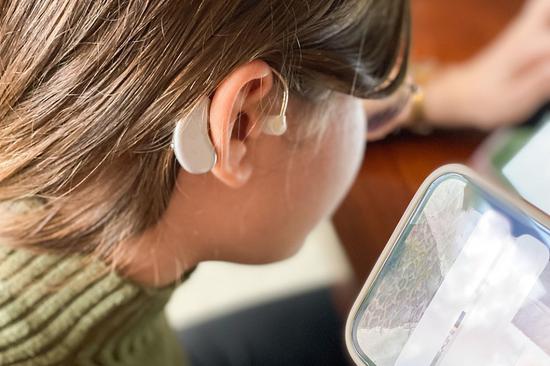 Cochlear implants now significantly cheaper