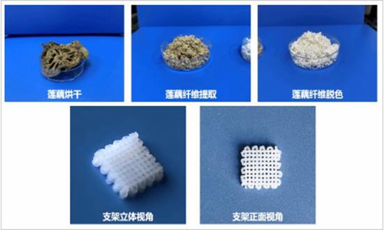 Research team in Hubei Province channels lotus roots into medical breakthrough