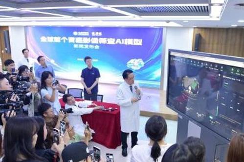 China unveils world's first AI model for early gastric cancer detection using CT scans