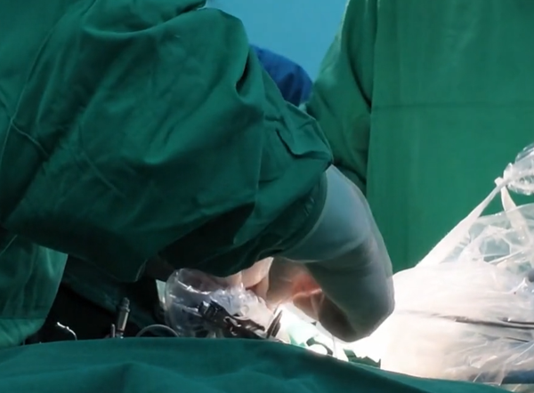 (Screenshot from CNS video)