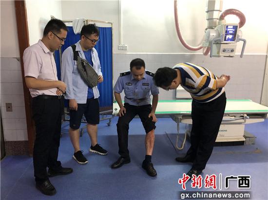 圖為李燕強在醫院接受檢查。 圖為李燕強在醫院接受檢查。