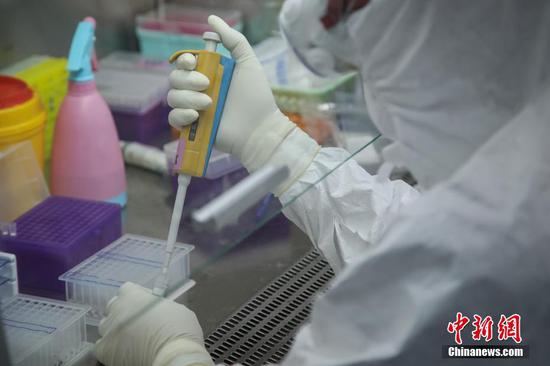 2月13日,贵州省人民医院检验科检测人员在添加核酸检测试剂。作为贵州省21家新冠肺炎核酸定点检测机构之一,该医院检验科10名检测人员分成三组,每天24小时轮班倒,不间断地进行检测。现医院每日检测量为100至200例,能实现当日采样当日送检。中新社记者 瞿宏伦 摄 2月13日,贵州省人民医院检验科检测人员在添加核酸检测试剂。作为贵州省21家新冠肺炎核酸定点检测机构之一,该医院检验科10名检测人员分成三组,每天24小时轮班倒,不间断地进行检测。现医院每日检测量为100至200例,能实现当日采样当日送检。中新社记者 瞿宏伦 摄