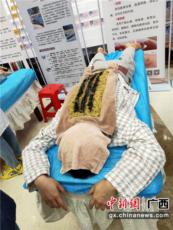 壮医特色治疗。罗先彬 摄 广西国际壮医医院举办首届中医养生文化节