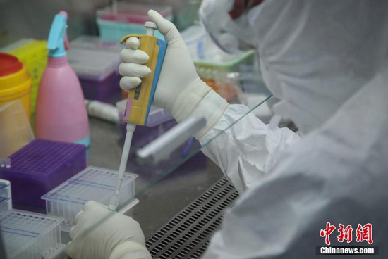 资料图:贵州省人民医院检验科检测人员在添加核酸检测试剂 瞿宏伦 摄