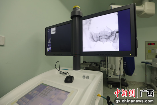 医生的“透视眼”和“稳定器” 破解骨科手术难题