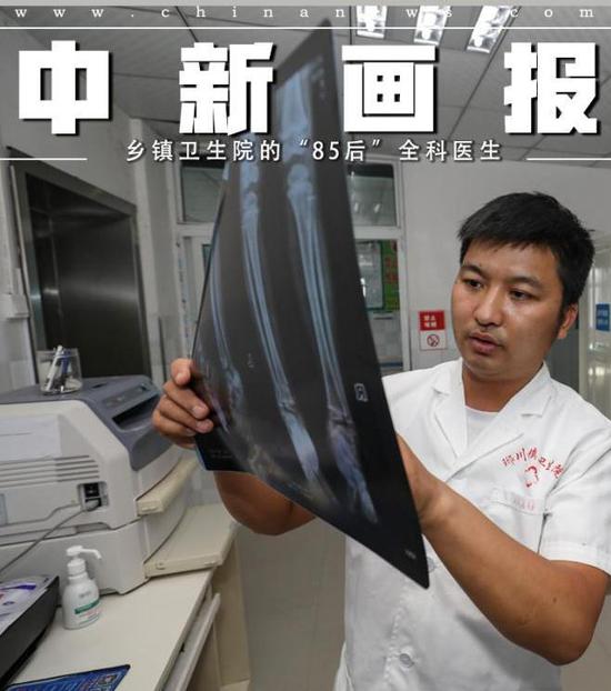 李田书在琊川镇中心卫生院研究患者的X光片。瞿宏伦 摄