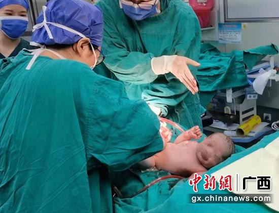 宝宝顺利诞生。广西壮族自治区人民医院 供图