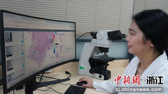 今年4月,病理科医生正在审核AI自动标记的病灶点。浙大二院供图 今年4月,病理科医生正在审核AI自动标记的病灶点。浙大二院供图
