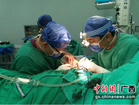 急诊科救治团队为断指患者实施手术。广西壮族自治区人民医院 供图