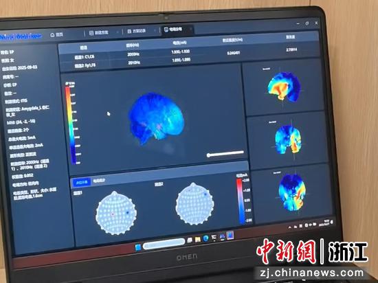 团队演示画面。张煜欢&nbsp;摄