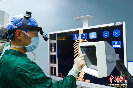 图为浙毕医院引入的新一代“非接触式可移动术中阅片系统”首次为患者完成脊柱侧弯矫形手术。毕节市委统战部供