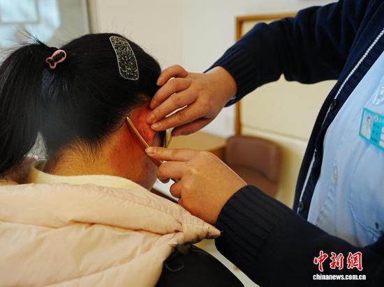 图为年轻人在贵州省铜仁市石阡县仡佬医馆进行耳部刮痧。中新网记者 周燕玲 摄