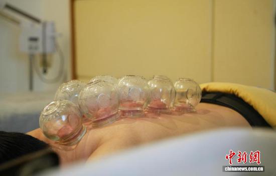 图为年轻人在贵州省铜仁市石阡县仡佬医馆体验平衡火罐。中新网记者 周燕玲 摄