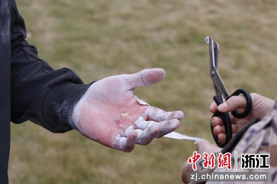 战士手上磨出的老茧。武警湖州支队供图 战士手上磨出的老茧。武警湖州支队供图