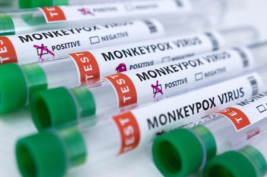 South Africa on high alert after Mpox death case