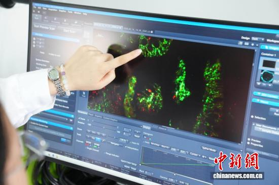China's innovative drug deals exceed $100 billion